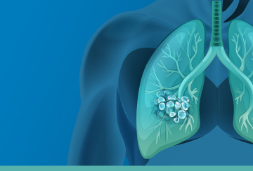 Lungs and Genetic Testing