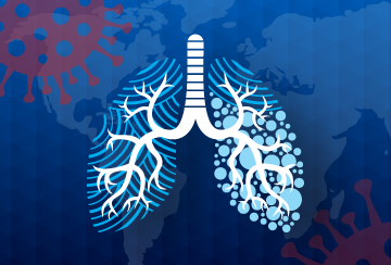 360-x-244-11818---PN---Article-Graphic-Covid-Lung-Cancer-copy